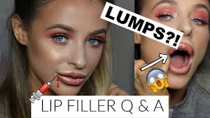 lip filler q a i have a lump on my