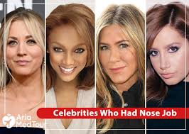 celebs who admitted they got nose job