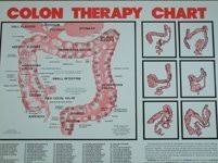 Amazon Com Colon Therapy Chart By Norman Walker By Norwalk