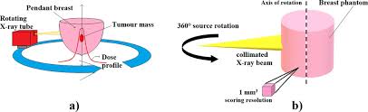 rotational radiotherapy of t