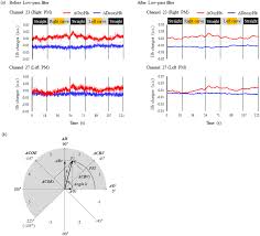 Greater Activity in the Frontal Cortex on Left Curves: A Vector-Based fNIRS Study of Left and Right Curve Driving | PLOS ONE