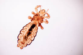 head lice pictures what does a lice