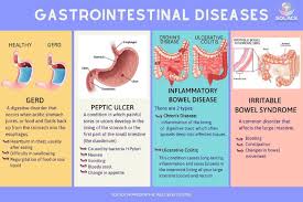 The healthcare system in malaysia. Solace Homeopathic Wellness Centre Today S Topic About Gastrointestinal Gi Diseases These 4 Diseases Are One Of The Most Common Cases In Malaysia That Affect Teenagers Adults If You Re Having