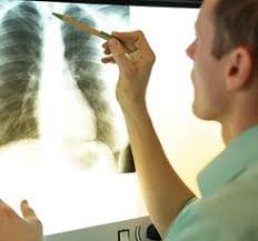 You'll learn about the most experienced mesothelioma lawyers in your area, how to file a claim for. Mesothelioma Asbestos Attorneys Krw Lawyers