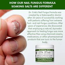 dr cole s nail fungus salt