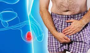 Rare = it happens to other people, so i ignored it. Testicular Cancer Six Early Signs And Symptoms That Could Indicate You Have The Disease Express Co Uk