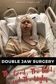 my double jaw surgery experience the