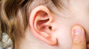 ear wax in children what to do about