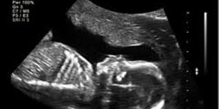 Der erste ultraschall deine checkliste für die ssw 9 Ultraschall In Der Schwangerschaft Familie De