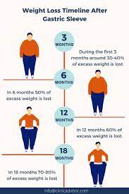 gastric sleeve in turkey how it works
