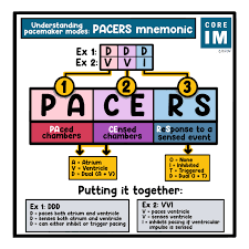 pacemakers icds 5 pearls segment