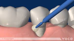 tooth pain relief in dunedin fl