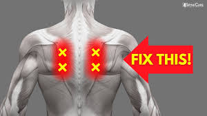 fix nerve pain in the shoulder blades