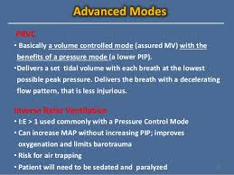 Approach To Mechanical Ventilation