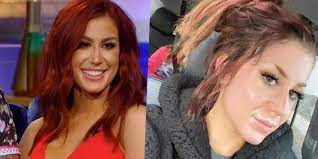 chelsea houska undergoes