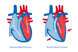 Systolic vs. Diastolic Blood Pressure - A&D Medical