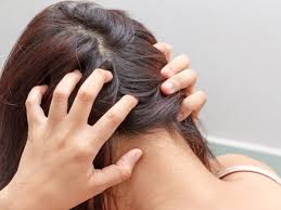 home remes for itchy scalp