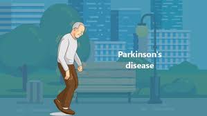 Parkinson's Disease: Causes, Symptoms, And Prevention - Medlife Blog: Health and Wellness Tips