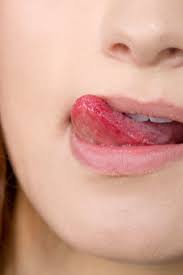 bitter taste in mouth symptoms causes