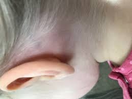 lymph node behind ear