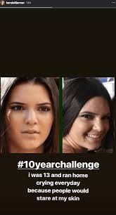 kendall jenner s acne marketing caign