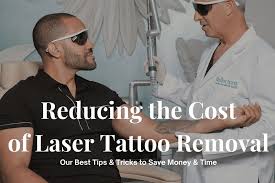 laser tattoo removal cost