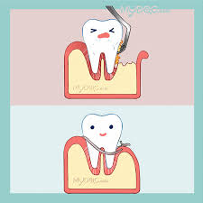 periodontal flap surgery in msia