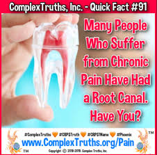 Could Root Canals May Be The Cause Of Your Chronic Pain A