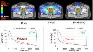 intensity modulated proton therapy