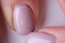 fix ed or broken acrylic nails