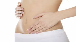 tummy tuck nuance cosmetic surgery