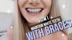 how i keep my teeth white with braces