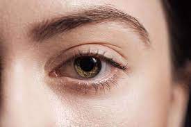 strengthen drooping eyelid muscles