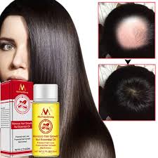 The way that cedarwood essential oil contributes to hair growth is by keeping your scalp healthy and happy, explains panton. Natural Andrea Hair Growth Products Ginger Oil Hair Growth Faster Grow Hair Ginger Shampoo Stop Hair Loss Treatment Hair Loss Products Aliexpress