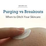 Image result for skin purging vs breakout