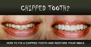 how to fix a chipped tooth saylor