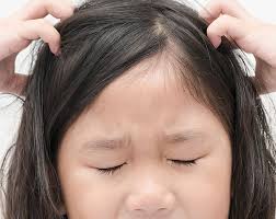 Lice are easily spread — especially by schoolchildren — through close personal contact the female louse lays eggs (nits) that stick to hair shafts. How To Spot Treat Head Lice Nits In Pre Schoolers Inspiration Advice Boots Ireland
