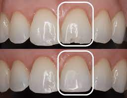 restoring smiles with precision and