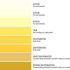 example of a urine color chart for