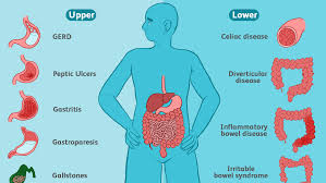 Resep sop iga sapi bening ala resto : Symptoms Of Common Stomach And Digestive Problems