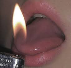 lighter lips and burning mouth image