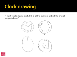 Put in all the numbers and set the time to 10 past 11. Cognitive Screening Tests Montreal Cognitive Assessment Moca Ppt Download