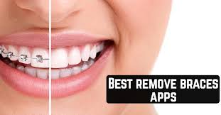 As the name suggests, these devices do not require the brackets to attach to the teeth and can therefore be removed by the patient. 11 Best Remove Braces Apps Android Ios App Pearl Best Mobile Apps For Android Ios Devices