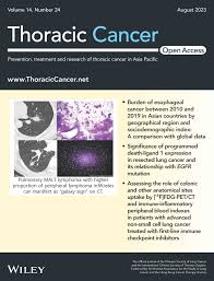 thoracic cancer wiley library