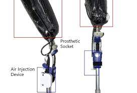 ai based prosthetic socket developed to