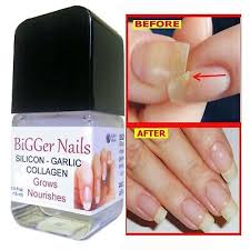 nail growth thickener gel garlic