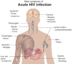 hiv clinical features management