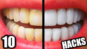 diy teeth whitening hacks