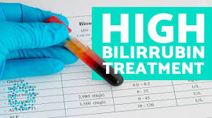 High Bilirubin Levels Symptoms And Treatment Youtube