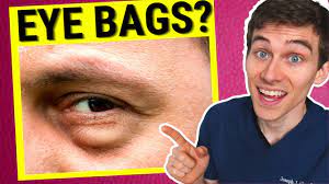 get rid of under eye bags